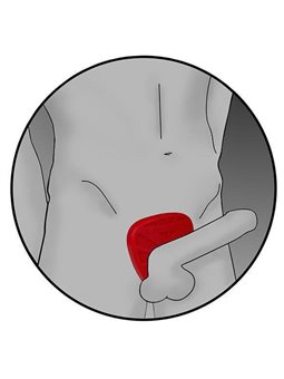 Electrastim  Silicone Fusion Viper Cock Shield